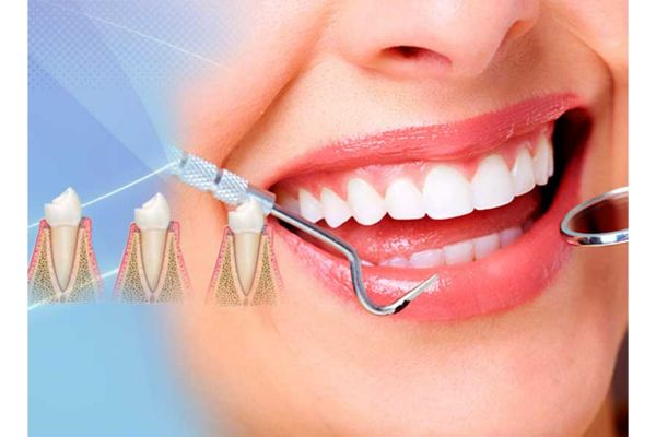 periodoncia-boadilla-del-monte-dientes
