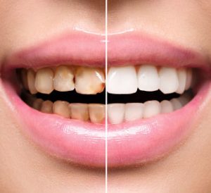 odontologia restauradora